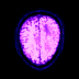 MRT/CT computed magnetic resonance imaging head scan stream deck animated gif icons